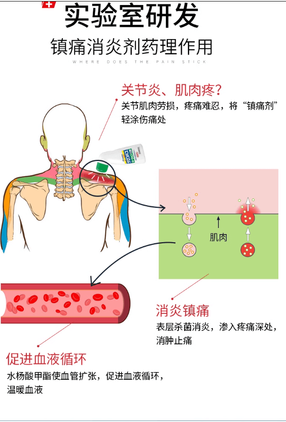 【日本 Hisamitsu】久光制药 Salonpas 撒隆巴斯/塞隆巴斯 疼痛涂抹液剂 消炎止痛 85ml -  - 4@ - Sweet Living